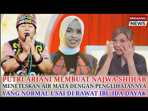 Najwa Shihab Tak Kuasa Tahan Air Mata Saat Putri Ariani Bisa Normal Usai Di Obati Bu Ida Dayak