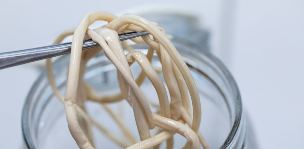 cacingan-picu-kematian-balita-di-sukabumi:-birokrasi-rumit,-anak-miskin-terabaikan