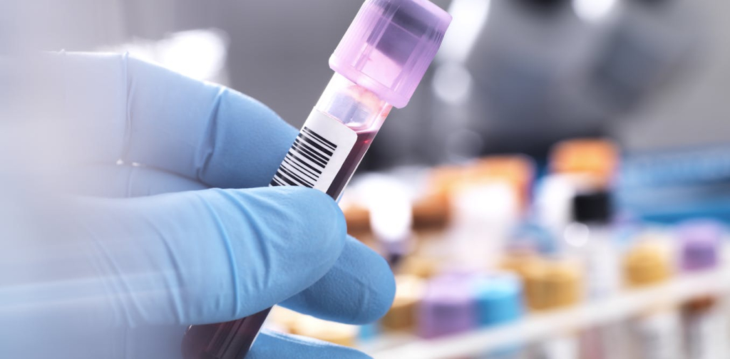 can-a-new-blood-test-really-detect-me/cfs?-an-expert-unpacks-new-research