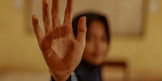 Robohnya Bantaeng Kami: Potret Sengsara Warga di Tengah Kepungan Debu dan Deru Kawasan Industri