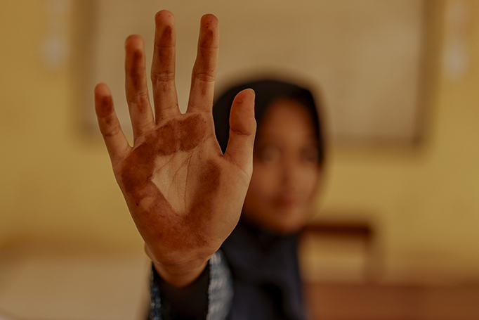 robohnya-bantaeng-kami:-potret-sengsara-warga-di-tengah-kepungan-debu-dan-deru-kawasan-industri