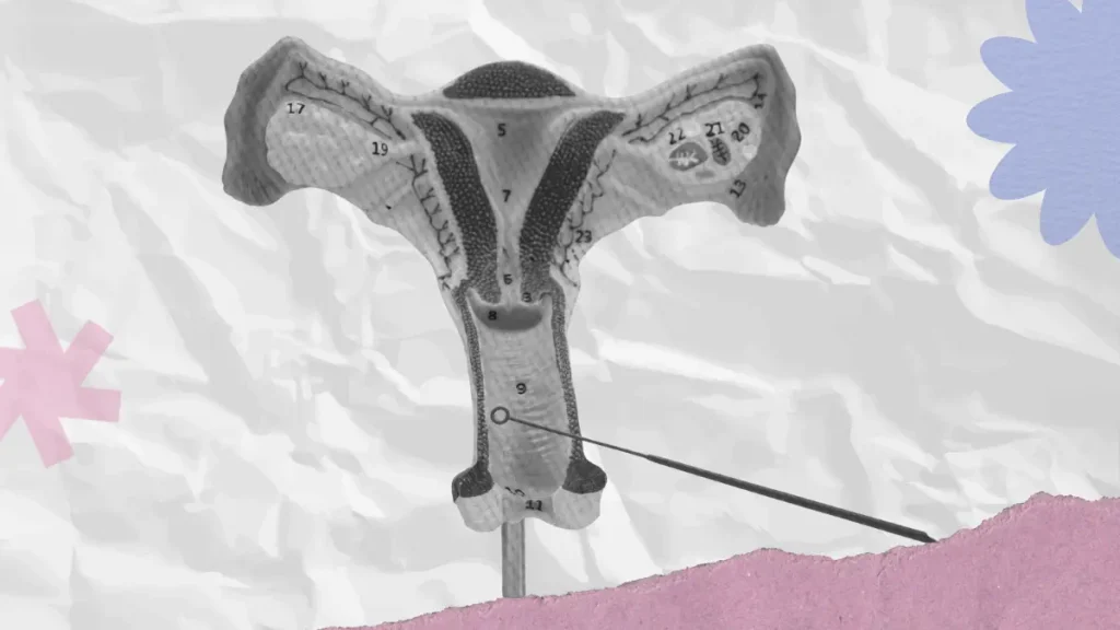 teal-wand:-skrining-kanker-serviks-bisa-di-rumah,-indonesia-kapan?