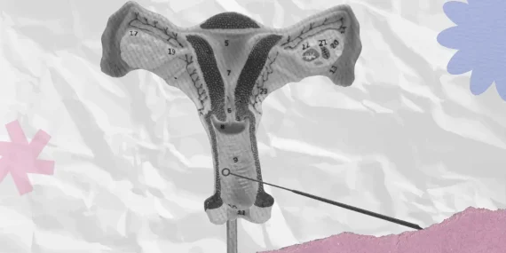 Teal Wand: Skrining Kanker Serviks Bisa di Rumah, Indonesia Kapan?