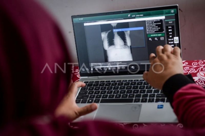 ri-tambah-anggaran-khusus-untuk-percepatan-deteksi-tbc-pada-2026