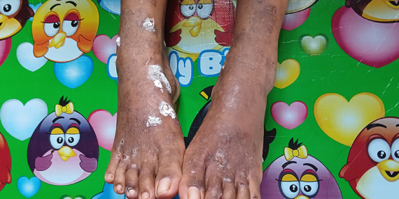 Mengail Lumpur, Menjaring Debu: Nelayan Hakatutobu Digulung Tambang Nikel