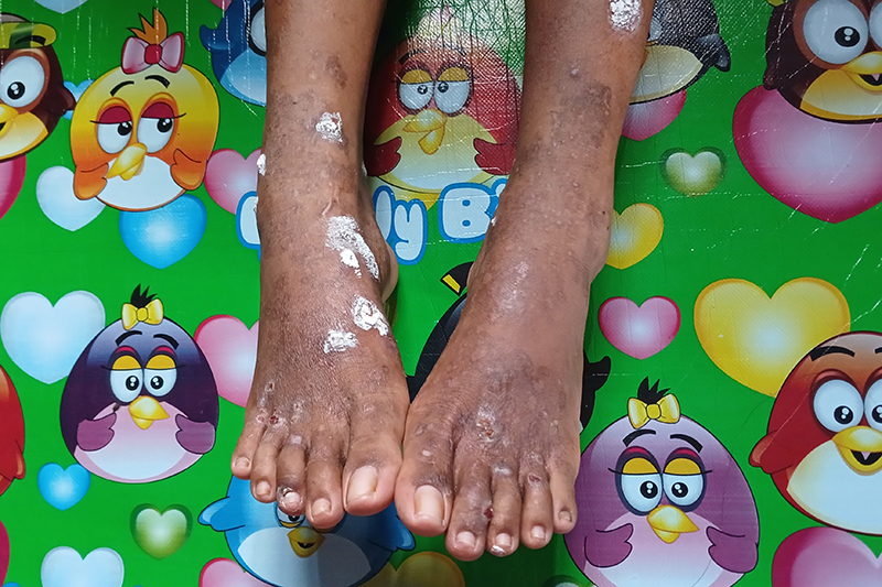 mengail-lumpur,-menjaring-debu:-nelayan-hakatutobu-digulung-tambang-nikel