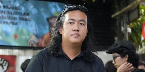RSCM: Mata Kanan Andrie KontraS Mengalami Trauma Kimia Fase Akut