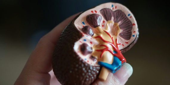 i’m-a-kidney-surgeon.-here’s-why-i-hope-i-never-see-you