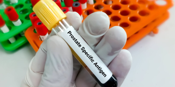 prostate-cancer-overdiagnosis-risk-sharply-rises-after-age-70-–-new-research