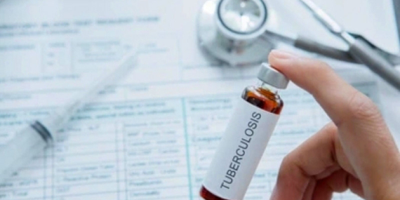 bagaimana-mempercepat-eliminasi-tuberkulosis-di-tanah-papua