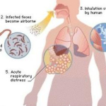 klaster-hantavirus-kapal-pesiar-berbendera-belanda-lintas-negara