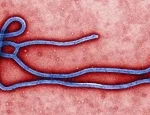 imbauan-bagi-masyarakat-indonesia-atas-merebaknya-penyakit-ebola