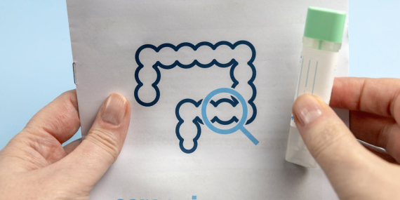 poop-tests-and-blood-tests-join-colonoscopy-as-options-for-colorectal-cancer-screening