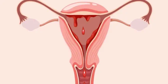 Cakupan Kesehatan Menstruasi