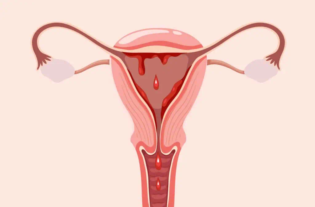 cakupan-kesehatan-menstruasi