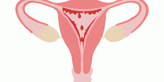 Fakta-Fakta Penting Kesehatan Menstruasi
