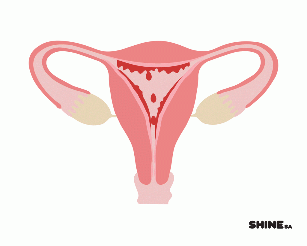 siapa-berisiko-saat-mengalami-menstruasi