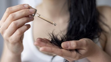 5-rekomendasi-hair-tonic-bantu-atasi-rambut-rontok