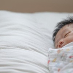 fakta-cutis-laxa,-kondisi-langka-penyebab-bayi-lahir-langsung-tua