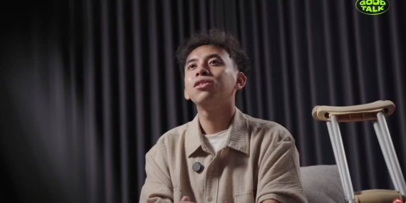 Anggi Wahyuda Obati Rasa Kehilangan Satu Kaki dengan Stand Up Comedy