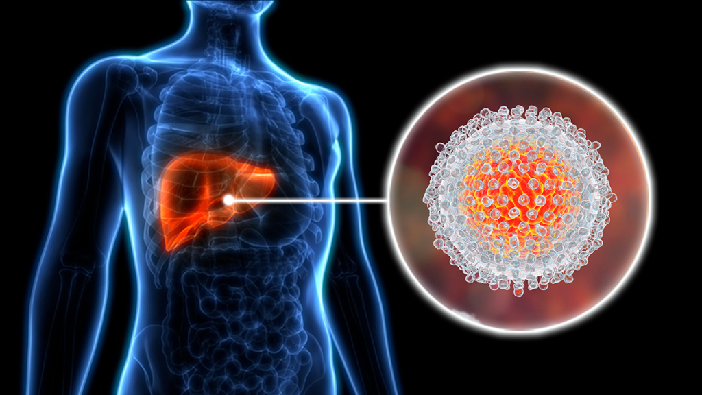 hari-hepatitis-sedunia:-hilangkan-hambatan-yang-memisahkan-masyarakat-dari-layanan