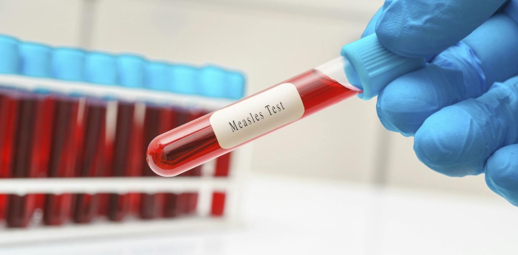 cdc-vs.-pennsylvania:-why-conflicting-public-health-messages-jeopardize-public-safety